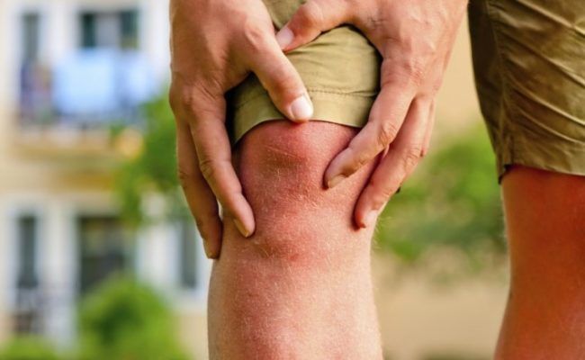 Ways to relieve arthritis pain