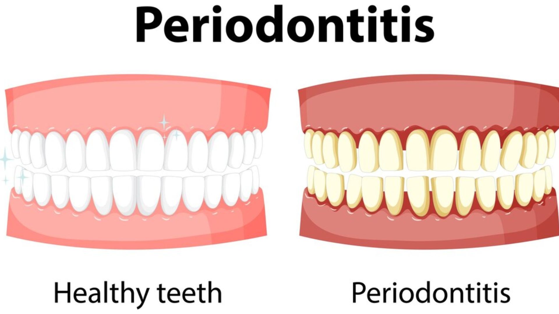 Pale-Gums